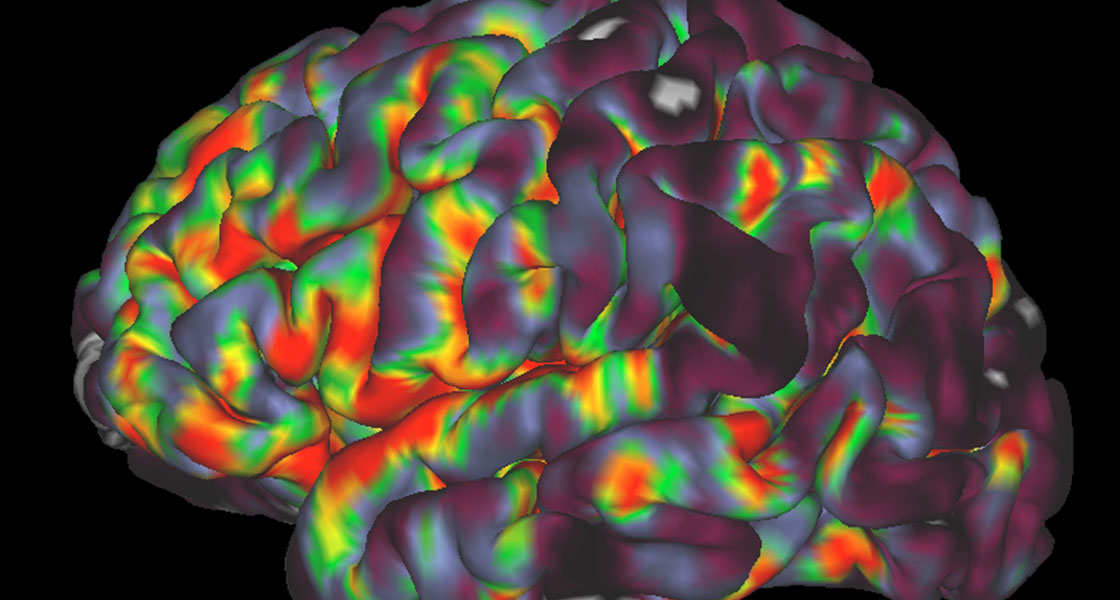 Blood Flow & Metabolism Bioimaging