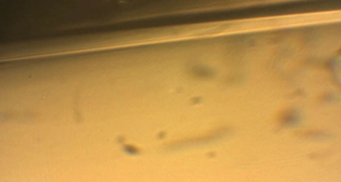 Cardiovascular Disease