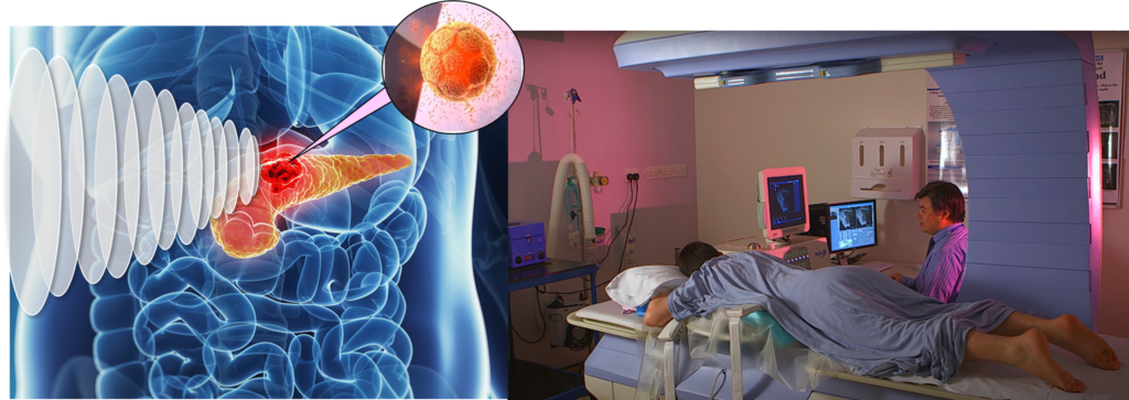 Focused Ultrasound Foundation Image of patient being treated or scanned with ultrasound device