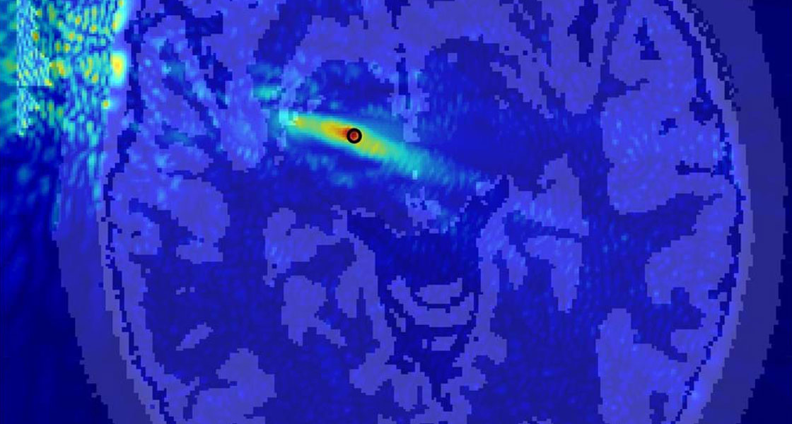 Neurofeedback Technologies