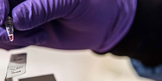 OxLAMP® – accurate and rapid COVID-19 test with no specialist equipment needed