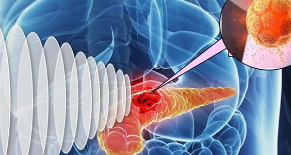 Targeted Drug Release