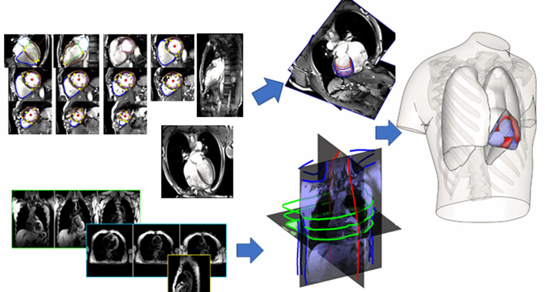 Pulmonary and Cardiovascular Imaging